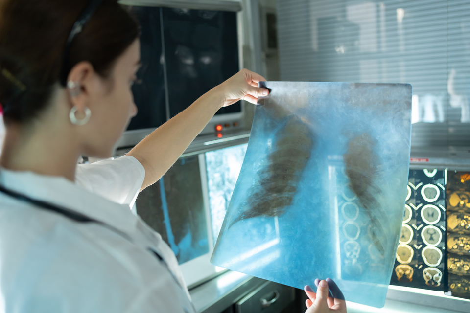 Medical professional looking at a chest x-ray.