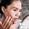 Woman with protruding cheekbones and thin face touches cheek and looks in handheld mirror.