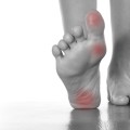 Person's feet on floor, one flat on ground, the other flexed, showing red areas on toe, ball & heel.