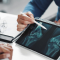 Two people's hands, one holding a tablet showing knee x ray.