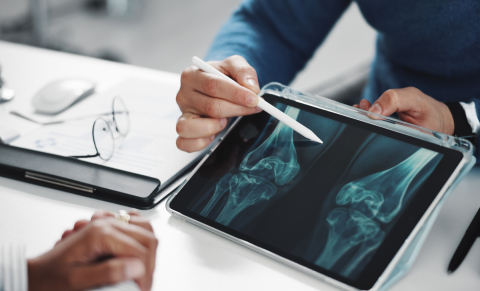 Two people's hands, one holding a tablet showing knee x ray.